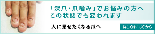 「深爪・爪噛み」でお悩みの方へこの状態でも変われます。人に見せたくなる爪へ